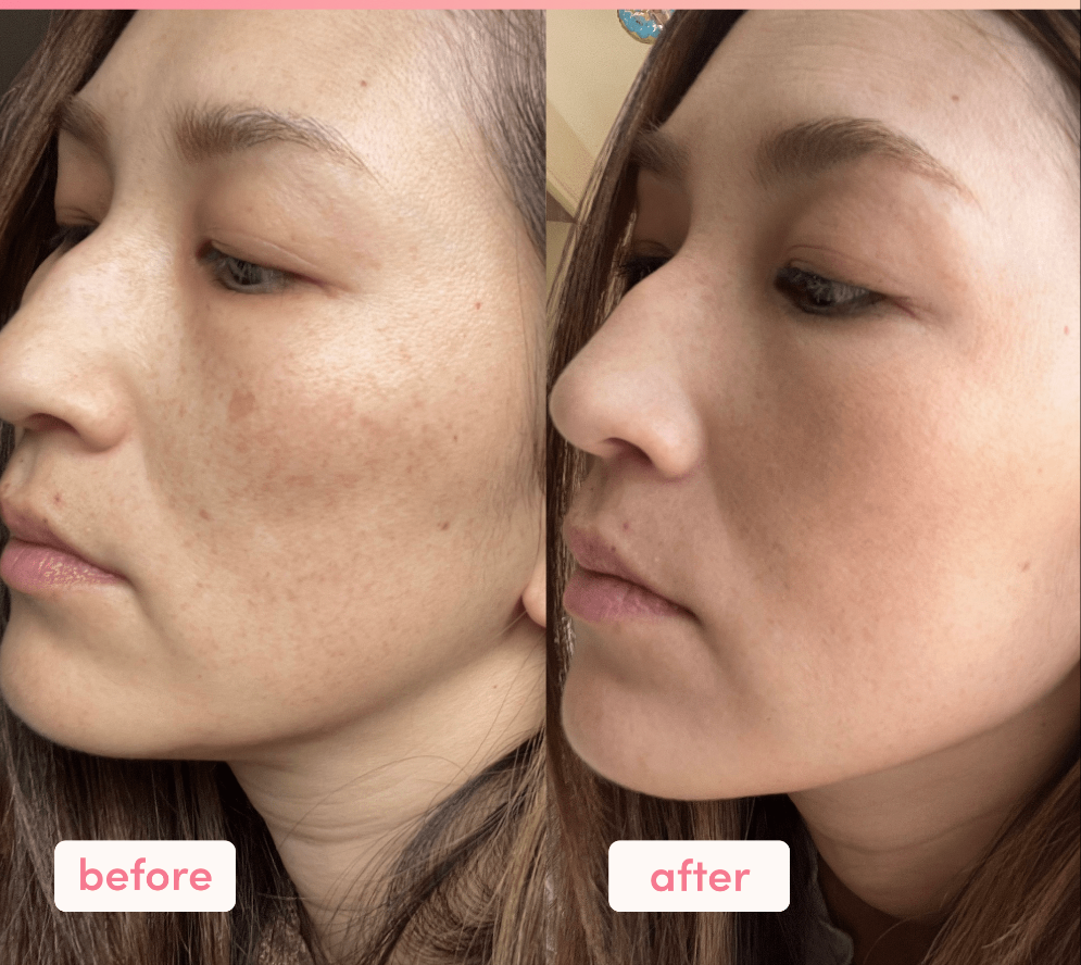 Inkey Collagen Peptide Serum