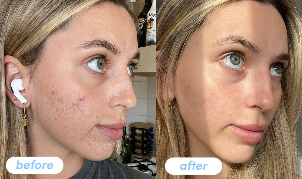 Inkey Collagen Peptide Serum