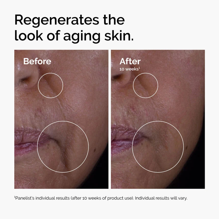 The Ordinary GF15%Solution