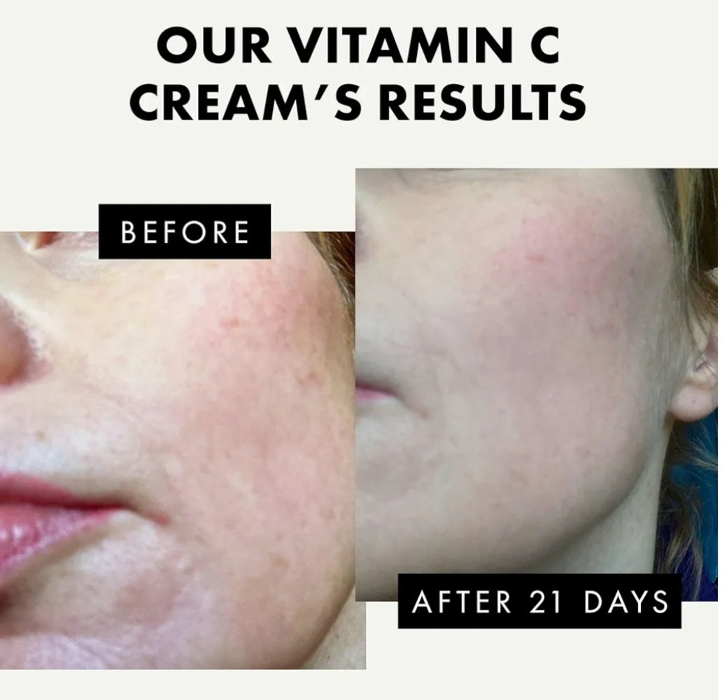 Eclat Vitamin C Cream