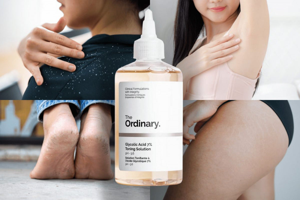 The Ordinary Glycolic Acid 7% Exfoliating Toner